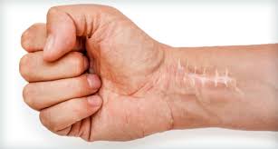 Assessoria para Compra de Carros com Isenção