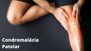 Assessoria para Compra de Carros com Isenção